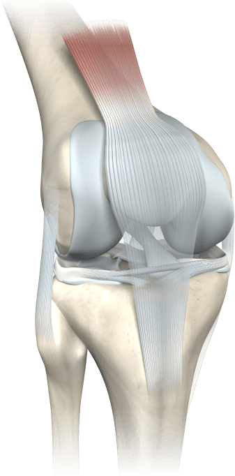 Fisio Forte - cómo funciona para las articulaciones en Guatemala